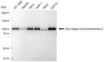 ZHX2 Antibody in Western Blot (WB)