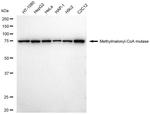 MUT Antibody in Western Blot (WB)
