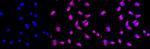 TDP-43 Recombinant Rabbit Monoclonal Antibody (23GB4730)
