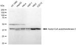 ACAT2 Recombinant Rabbit Monoclonal Antibody (23GB4745)