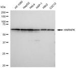 hnRNP K Recombinant Rabbit Monoclonal Antibody (23GB4825)