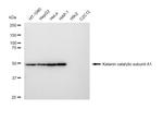 KATNA1 Recombinant Rabbit Monoclonal Antibody (23GB4765)