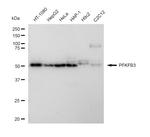 PFKFB3 Recombinant Rabbit Monoclonal Antibody (23GB4880)