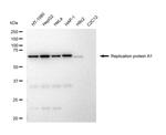 RPA70 Recombinant Rabbit Monoclonal Antibody (23GB4885)