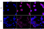 gamma Tubulin Antibody in Immunocytochemistry (ICC/IF)