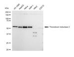 TrxR2 Recombinant Rabbit Monoclonal Antibody (23GB4925)