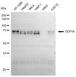 DCP1A Recombinant Rabbit Monoclonal Antibody (23GB5150)