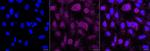 DSC1 Recombinant Rabbit Monoclonal Antibody (23GB5210)