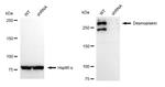 Desmoplakin Antibody