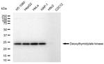 DTYMK Recombinant Rabbit Monoclonal Antibody (23GB5235)