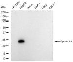 Ephrin A1 Recombinant Rabbit Monoclonal Antibody (23GB5265)