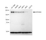 GCN2 Recombinant Rabbit Monoclonal Antibody (23GB5295)