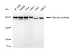 FASN Recombinant Rabbit Monoclonal Antibody (23GB5380)