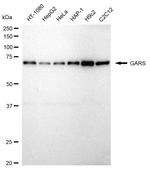 GARS Recombinant Rabbit Monoclonal Antibody (23GB5515)