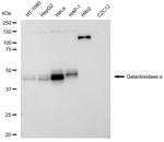 alpha Galactosidase Recombinant Rabbit Monoclonal Antibody (23GB5545)