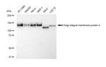 GOLIM4 Recombinant Rabbit Monoclonal Antibody (23GB5575)