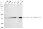 GOT1 Recombinant Rabbit Monoclonal Antibody (23GB5585)