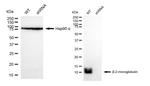 beta-2 Microglobulin Antibody