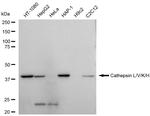 Cathepsin H/K/L/V Recombinant Rabbit Monoclonal Antibody (23GB5780)