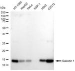 Galectin 1 Recombinant Rabbit Monoclonal Antibody (23GB6025)