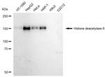 HDAC6 Recombinant Rabbit Monoclonal Antibody (23GB6170)