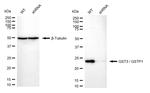 GSTP1 Antibody