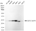 GSTP1 Recombinant Rabbit Monoclonal Antibody (23GB6420)