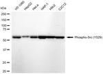 Phospho-SRC (Tyr529) Recombinant Rabbit Monoclonal Antibody (23GB6690)