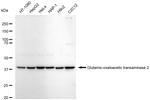 GOT2 Recombinant Rabbit Monoclonal Antibody (23GB7985)
