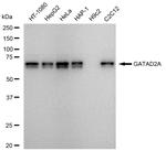 GATAD2A Recombinant Rabbit Monoclonal Antibody (23GB5685)