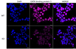 GATA3 Antibody in Immunocytochemistry (ICC/IF)