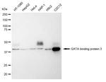 GATA3 Recombinant Rabbit Monoclonal Antibody (23GB1165)