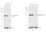 Glutamine Synthetase Antibody in Western Blot (WB)