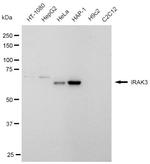 IRAK-M Antibody in Western Blot (WB)