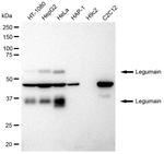 LGMN Recombinant Rabbit Monoclonal Antibody (23GB2095)