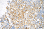 Active/Pro-Caspase 3 Antibody in Immunohistochemistry (Paraffin) (IHC (P))