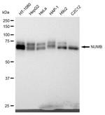 NUMB Recombinant Rabbit Monoclonal Antibody (23GB1070)