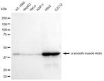 Alpha-Smooth Muscle Actin Antibody in Western Blot (WB)