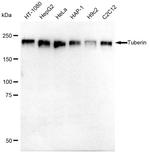 TSC2 Recombinant Rabbit Monoclonal Antibody (23GB1120)