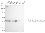 ACAT1 Antibody in Western Blot (WB)
