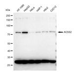 ACSS2 Recombinant Rabbit Monoclonal Antibody (23GB1705)