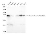 Phospho-PKR (Thr451) Antibody in Western Blot (WB)