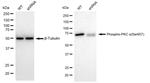 Phospho-PKC alpha (Ser657) Antibody