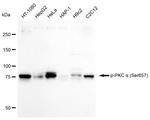 Phospho-PKC alpha (Ser657) Antibody in Western Blot (WB)