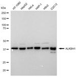 ABH1 Antibody in Western Blot (WB)