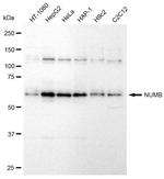 NUMB Recombinant Rabbit Monoclonal Antibody (23GB940)