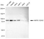 EZH2 Recombinant Rabbit Monoclonal Antibody (23GB835)