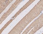 MYH2 Antibody in Immunohistochemistry (Paraffin) (IHC (P))