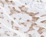MYH2 Antibody in Immunohistochemistry (Paraffin) (IHC (P))