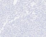 MYH2 Antibody in Immunohistochemistry (Paraffin) (IHC (P))
